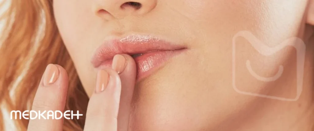 مراقبت از لب ها در تابستان