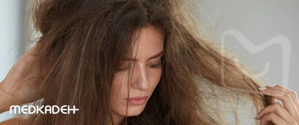 دلایل وز شدن مو