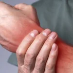 آسیب های مچ دست
